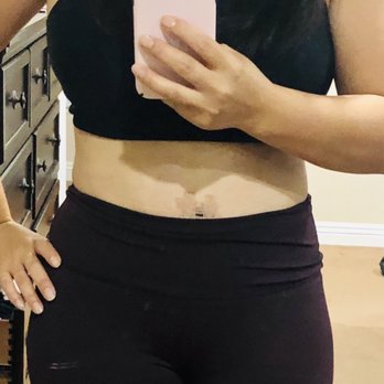 T.Y. Steven Ip, MD - Post Op 4 wks recovery. I'm loving my new body. - Cosmetic Surgeons Near Me - Newport Beach, California T.Y. Steven Ip, MD - Post Op 4 wks recovery. I'm loving my new body. - Cosmetic Surgeons Near Me - Newport Beach, California