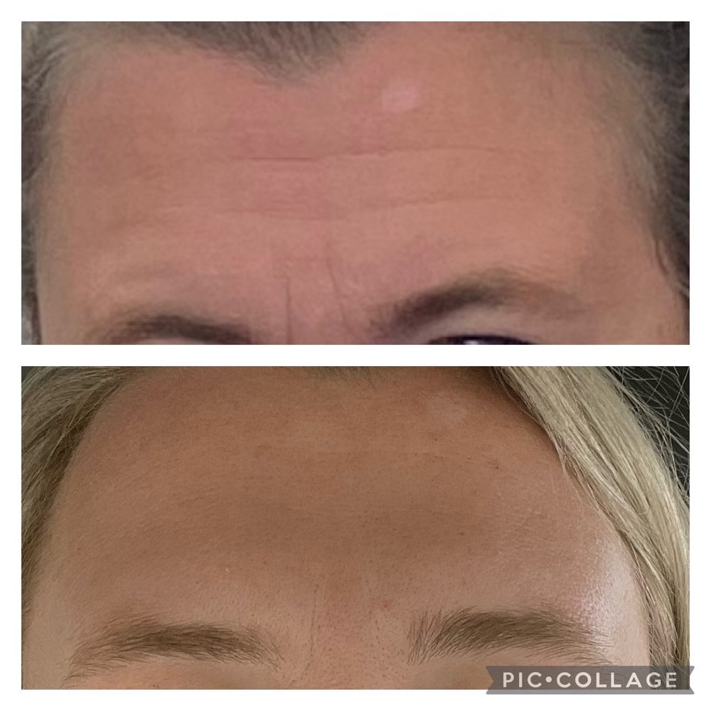 FACE FORWARD SKIN CARE CENTER Updated September 2024 10 Reviews 2953 Columbia Ave