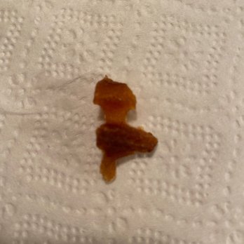 Chick-fil-A - ows a bed bug on a white towel - Chicken Shop Near Me - Medford, Oregon Chick-fil-A - ows a bed bug on a white towel - Chicken Shop Near Me - Medford, Oregon