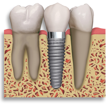 Samuel Ahdout, DMD - Dental Implant - Periodontists Near Me - Irvine, California Samuel Ahdout, DMD - Dental Implant - Periodontists Near Me - Irvine, California