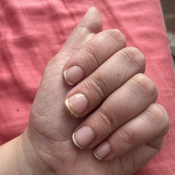 Beauty for You - Major discoloration - Nail Salons Near Me - San Francisco, California