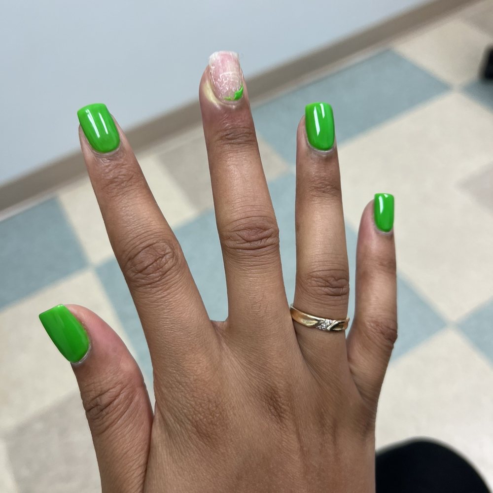 Nail infection + treatment