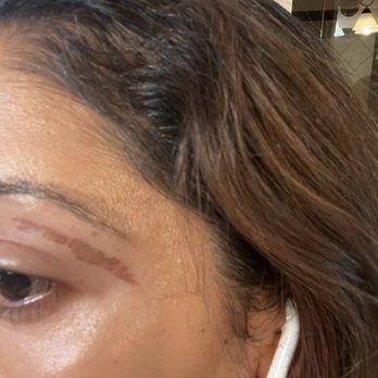 Princess Nails & Spa - Burns on day 3, it's honestly painful to blink - Nail Salons Near Me - Bakersfield, California Princess Nails & Spa - Burns on day 3, it's honestly painful to blink - Nail Salons Near Me - Bakersfield, California