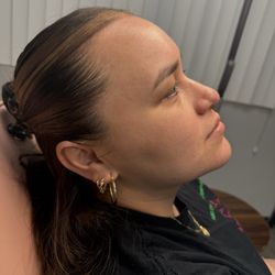 The Beauty Concierge MD - My face glowing still after 5 days!!!