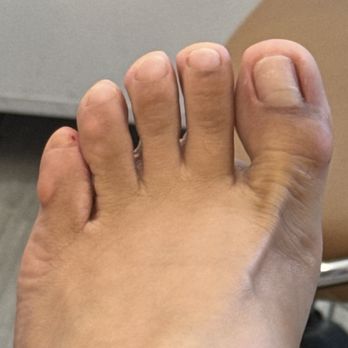 Sugar Nail - Cut on my pinkie toe - Nail Salons Near Me - Los Angeles, California Sugar Nail - Cut on my pinkie toe - Nail Salons Near Me - Los Angeles, California