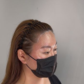 Chuldu Scalp Micropigmentation - Hairline smp before - Hair Loss Centers Near Me - Los Angeles, California