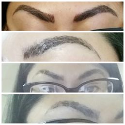 My healing process with the scabbing. My healing process with the scabbing.