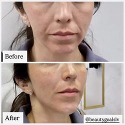 Facial balancing