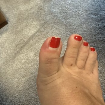 Maile's Nails - Infected toe from pedicure. You can see where the nail lady cut out the side of my nail. - Nail Salons Near Me - Chula Vista, California Maile's Nails - Infected toe from pedicure. You can see where the nail lady cut out the side of my nail. - Nail Salons Near Me - Chula Vista, California