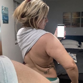 BelleSculpt - Body Contouring Near Me - Tulsa, Oklahoma BelleSculpt - Body Contouring Near Me - Tulsa, Oklahoma