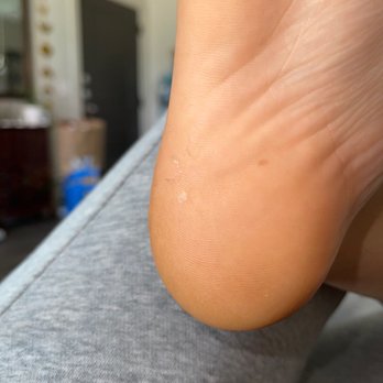 Ann's Nails - Barely exfoliated my heel - Nail Salons Near Me - San Antonio, Texas