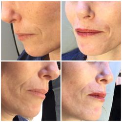 Advanced Permanent Cosmetics by K & V - Lip enhancement, symmetry & color.