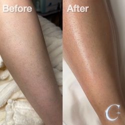 C The Beauty Esthetics - Sugaring (Legs)