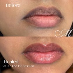 Permanent Makeup by Millie - Dark lip neutralization