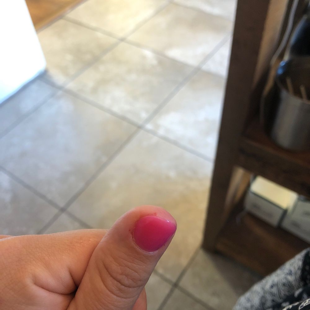 Left with HOLES in my fingers so painful and hoping I don't get an infection now! Left with HOLES in my fingers so painful and hoping I don't get an infection now!