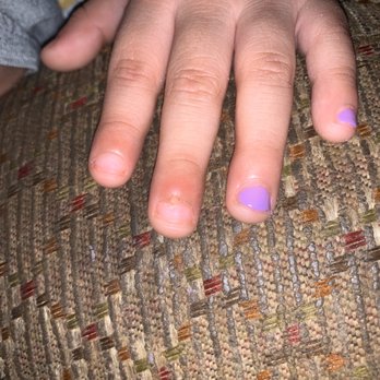 Gossip & Co. Nail Spa - My 5yr olds infection after a mani - Nail Salons Near Me - Cypress, Texas Gossip & Co. Nail Spa - My 5yr olds infection after a mani - Nail Salons Near Me - Cypress, Texas