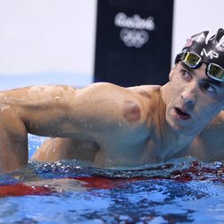 East 2 West Integrative Medicine - Michael Phelps starts an Olympic cupping trend.