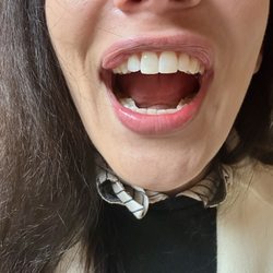 Historic Core Dental Care - Teeth fixed in 10 minutes