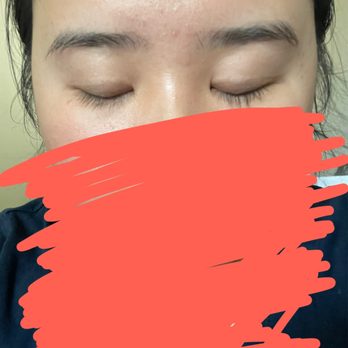 Dr. Kenneth Kim Plastic Surgery - This is today lol June 2023 - Plastic Surgeons Near Me - Los Angeles, California Dr. Kenneth Kim Plastic Surgery - This is today lol June 2023 - Plastic Surgeons Near Me - Los Angeles, California