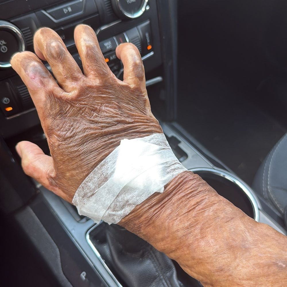 Quest Diagnostics - Blood draw from the top of my palm - Laboratory Testing Near Me - Pearland, Texas Quest Diagnostics - Blood draw from the top of my palm - Laboratory Testing Near Me - Pearland, Texas