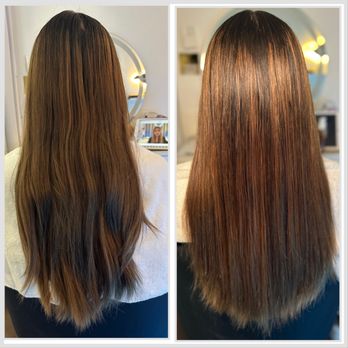 Vitality Vibe Spa - Before and after - Skin Care Near Me - Huntington Beach, California Vitality Vibe Spa - Before and after - Skin Care Near Me - Huntington Beach, California