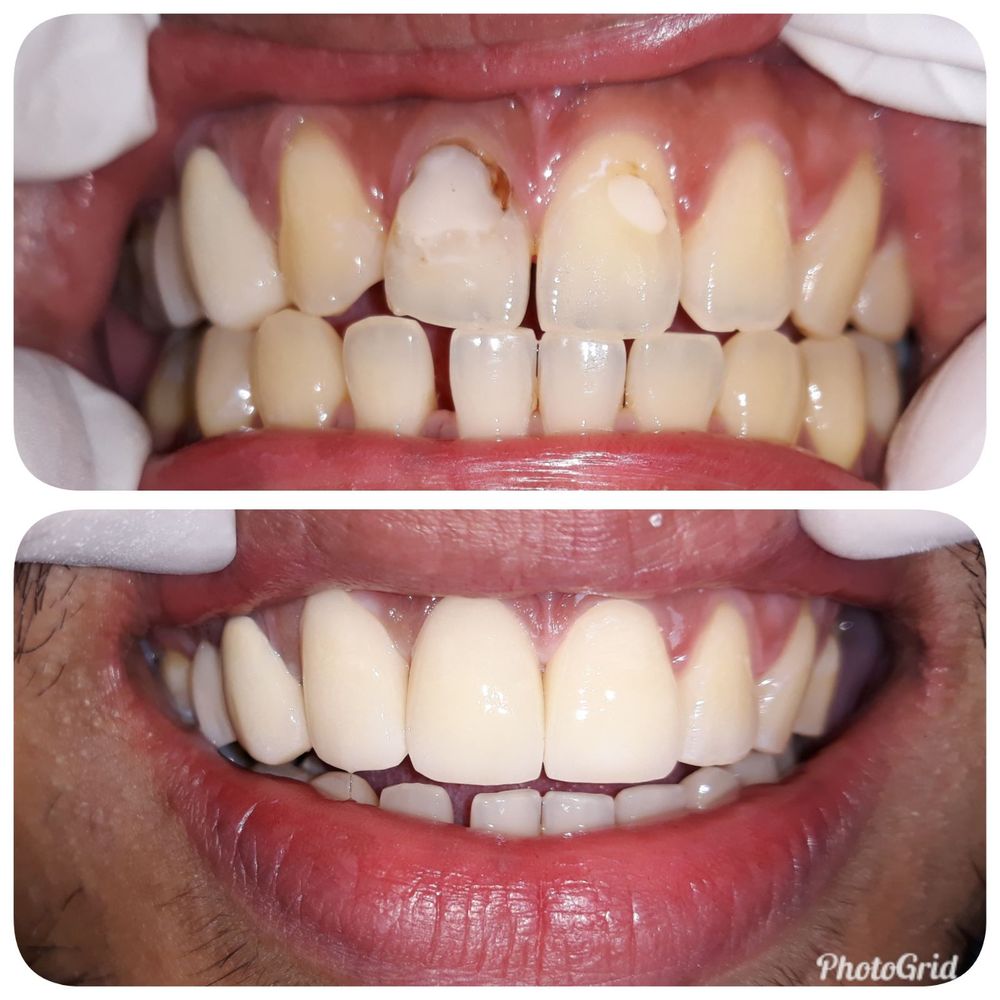 ESCOSIA DENTAL CLINIC 21 Photos 1251C Zobel Roxas St., Manila