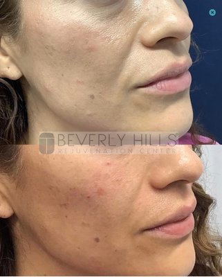 Beverly Hills Rejuvenation Center Westlake Village by null