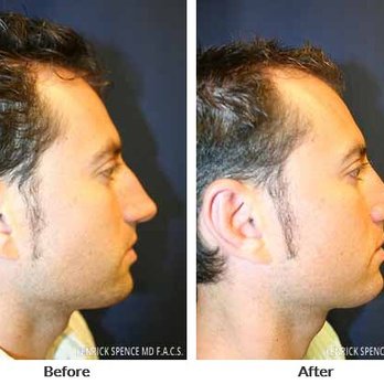 Hillcrest Plastic Surgery - Medical Spas Near Me - Orlando, Florida Hillcrest Plastic Surgery - Medical Spas Near Me - Orlando, Florida
