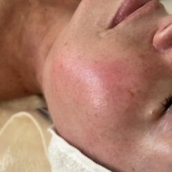 Spa La La Tampa - Our hydrating plumping #antiagingfacial reveals rejuvenated glowing skin. #facialsouthtampa #glassskin