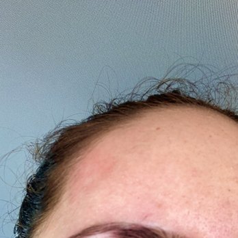 Simky’s Brow Bar - So red and damaged. Save your skin, don't go here!!! - Threading Services Near Me - Fort Lauderdale, Florida Simky’s Brow Bar - So red and damaged. Save your skin, don't go here!!! - Threading Services Near Me - Fort Lauderdale, Florida