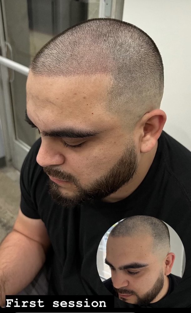 Evolution 360° Scalp Micropigmentation Logo