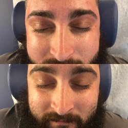 Wild Wax Center - Before and after of waxing eyebrow, nose & cheeks