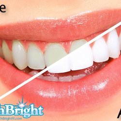 Heavenly Glow - We offer in salon BleachBright!