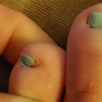 Studio Nails - Another sloppy nail thats becoming infected and peeling - Nail Salons Near Me - Panorama City, California Studio Nails - Another sloppy nail thats becoming infected and peeling - Nail Salons Near Me - Panorama City, California
