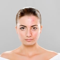Laserase Medical Skincare Clinic