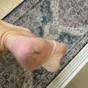 Lake Elsinore Nails - Still a deep crack left right after my pedi. Should have been much better with a callus removal and paraffin treatment. Very dissatisfied. - Nail Salons Near Me - Lake Elsinore, California