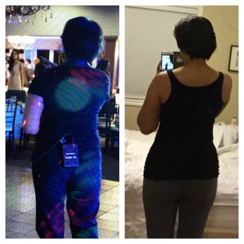 iSkin Med Spa - My Before and After : after 2 weeks of doing the 20/60 program - Skin Care Near Me - Beverly Hills, California