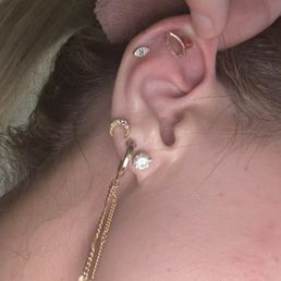 Lump above piercing Lump above piercing