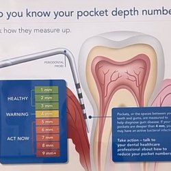 Certus Dental Care - Indepth measurements