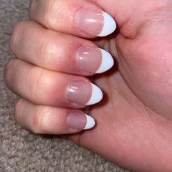 Victoria Nails - They are so ugly, uneven, and my nail beds are so swollen.