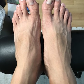 Serendipity Nail n Beauty bar - My hubby's feet after...nicer cleaner nails. - Nail Salons Near Me - Honolulu, Hawaii Serendipity Nail n Beauty bar - My hubby's feet after...nicer cleaner nails. - Nail Salons Near Me - Honolulu, Hawaii