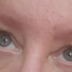 Right eye is so bad.
