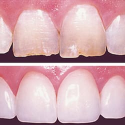 Andrew Gazerro III, DMD - Rediscover Your Smiile!