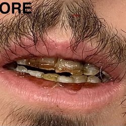 Baptist Medical Center South - I asked multiple nurses multiple times to clean his teeth!
