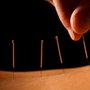 Photo of Trinity Acupuncture of Doylestown