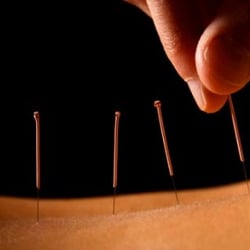 Trinity Acupuncture of Doylestown