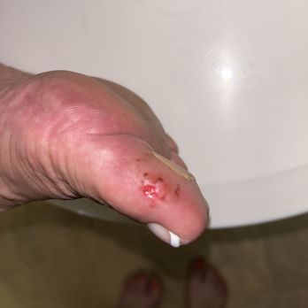 The Nailbox - Pedicure gone wrong!!! - Waxing Near Me - Lomita, California The Nailbox - Pedicure gone wrong!!! - Waxing Near Me - Lomita, California