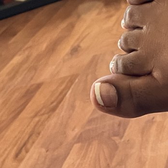 Sunset Nails - Cut my big toe nail funky - Nail Salons Near Me - Mesa, Arizona Sunset Nails - Cut my big toe nail funky - Nail Salons Near Me - Mesa, Arizona