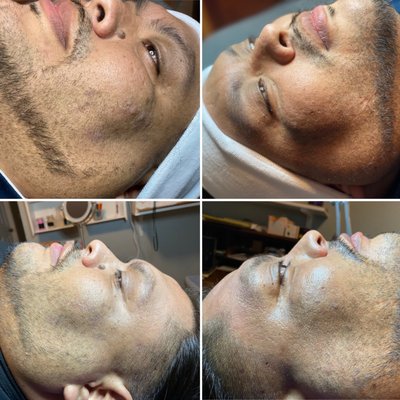 Mirame Skin Treatments by null