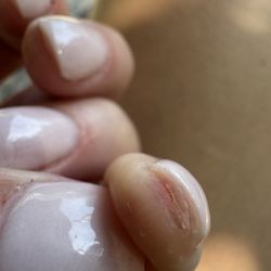 Luxe Nailbar - Bleeding fingers with tons of cured dip under the nail.